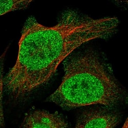 TRANK1 Antibody, Novus Biologicals 0.1mL; Unlabeled:Antibodies, Polyclonal